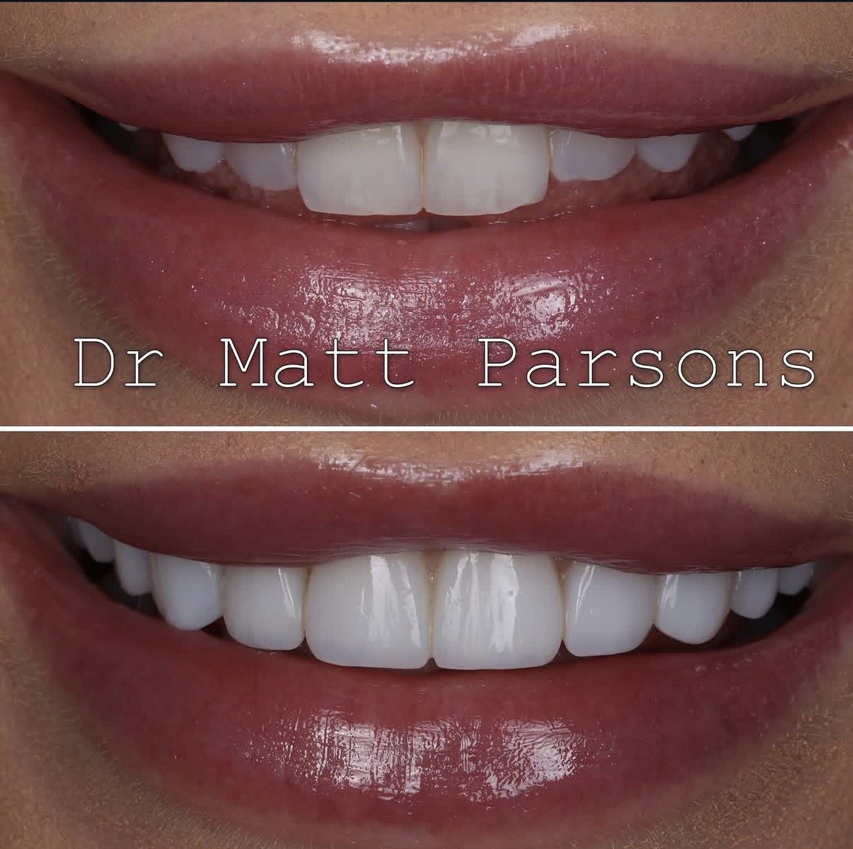 Instagram post by Dr. Matt Parsons